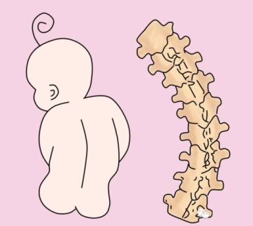 财经频道--智米拉:别再让婴儿背带伤害了宝宝脊柱